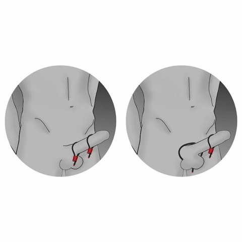 ElectraStim Prestige ElectraLoops czarne - regulowane pierścienie elektro-stymulujące