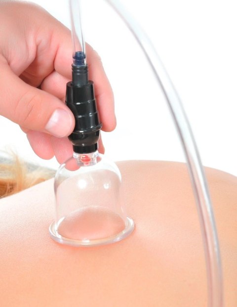 Pipedream Fetish Fantasy Series zestaw do stymulacji prożniowej 6 przyssawek