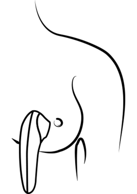 ROMP Switch X - ORANGE